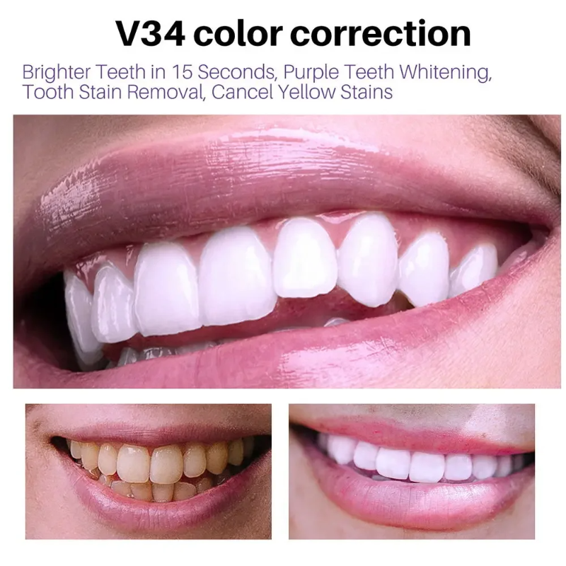 V34 معجون أسنان موس ، تبييض الأسنان ، تنظيف بقع الأسنان ، إزالة الأسنان الصفراء عن طريق الفم ، منتج العناية بالأسنان الطازجة ، جديد ، 50 * ،
