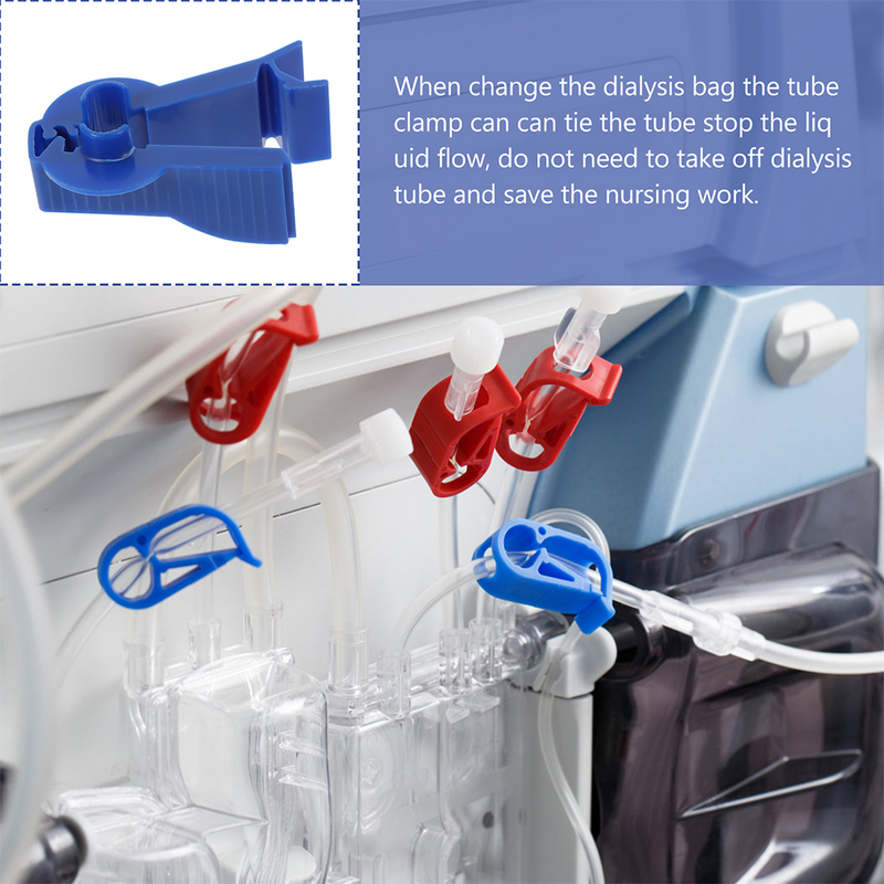 Peritoneal Flow Control Clips ABS Peritoneal Clips Tube Clamp Tube Fastener Clip Dialysis Clamp Blue Tubing Clip 6.5cm