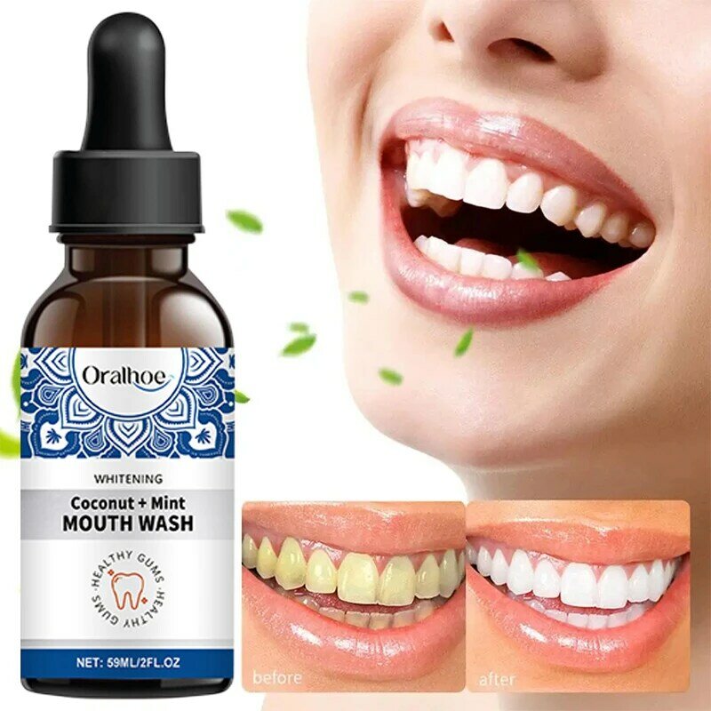Enxaguante bucal de odor oral, remove tártaro e manchas dentárias, boca limpa de odor, clareia a boca nova, higiene bucal, 59ml