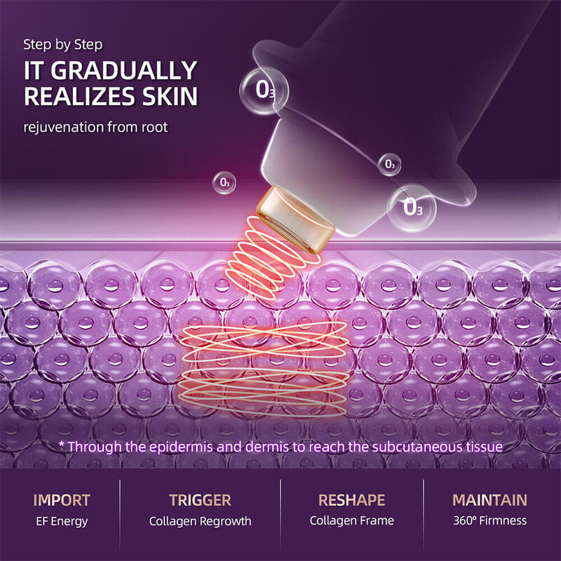 12 livelli RF EMS mesoterapia penna di bellezza elettroporazione radiofrequenza macchina per il sollevamento del viso ringiovanimento della pelle stringere illuminare