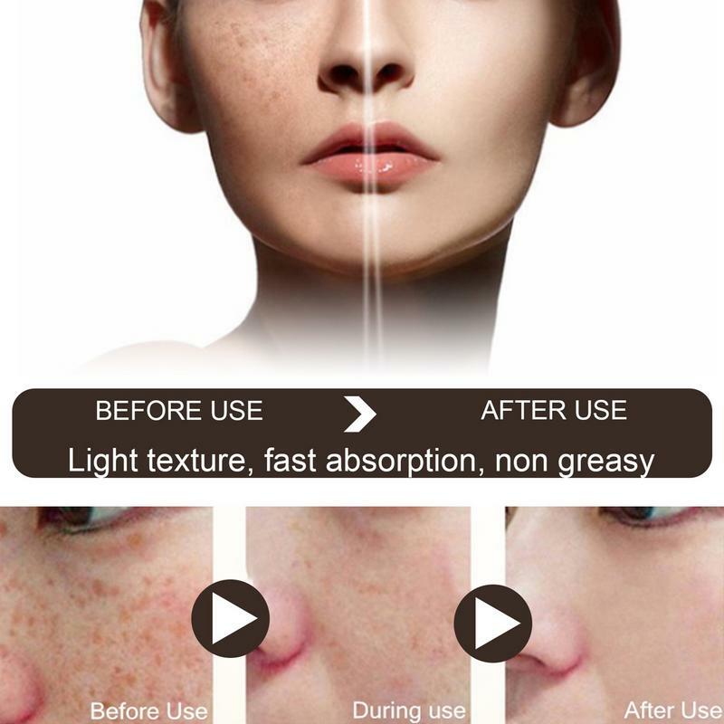 Crème éclaircissante pour le visage, hydratant et éclaircissant, soins de la peau, dissolvant de taches noires visiblement, SAP