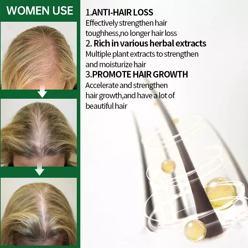 Искусственные волосы для мужчин и женщин, средство против выпадения волос, продукты для восстановления кожи головы, имбирь, корень гоны, эфирные масла 20 мл