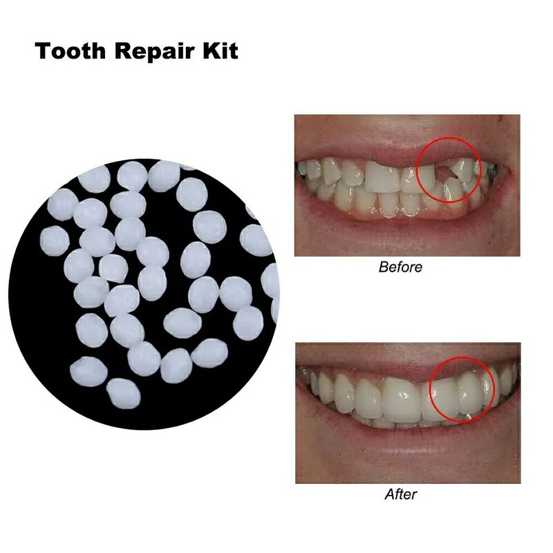 Quente 5g/10g/15g kit de reparação temporária dente dentes e lacunas falseteeth sólido cola dentadura dentes adesivos branqueamento dente ferramentas