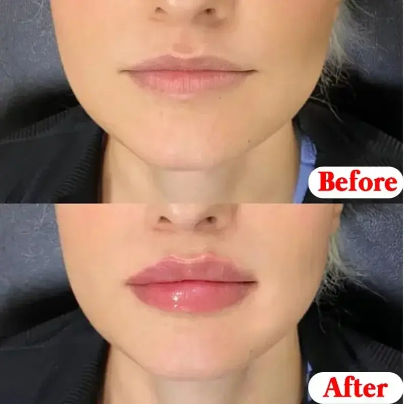 1 Pcs ลิปบาล์มให้ความชุ่มชื้นสดชื่นไม่เหนียวเหนอะหนะผลไม้ Anti-Cracked Lip Treatment Vaseline สำหรับแต่งหน้า Lip กลอส