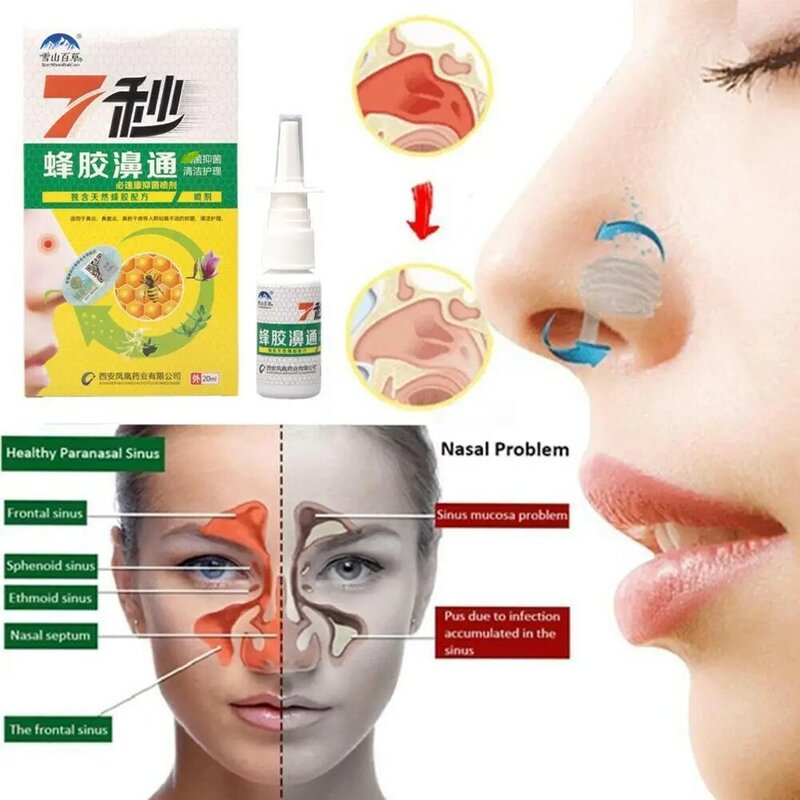 Spray nasale da 20ml per alleviare il disagio nasale estratto di propoli gocce nasali prurito che cola rinite allergica naso assistenza sanitaria