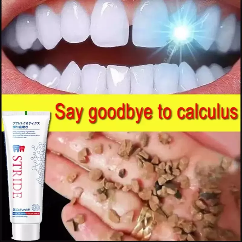 Removedor de cálculo Dental, blanqueamiento de dientes, pasta de dientes, prevención de brillo, prevención de Periodontitis, cuidado de limpieza Dental, eliminación de mal aliento