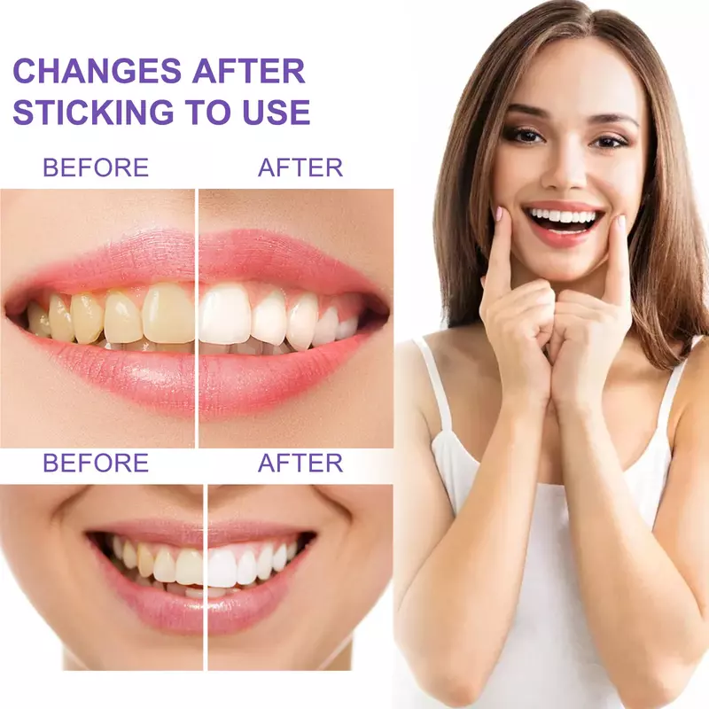 Eelhoe dentífrico branqueamento dentes remove café manchas de fumaça respiração fresca higiene oral cuidados dentífrico rápido e frete grátis