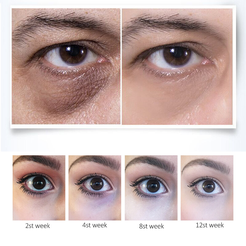 Retinol nawilżający krem przeciwzmarszczkowy przeciw zmarszczkom Anit Aging usuń worki pod oczami opuchlizna pielęgnacja skóry rozjaśnij ujędrniający