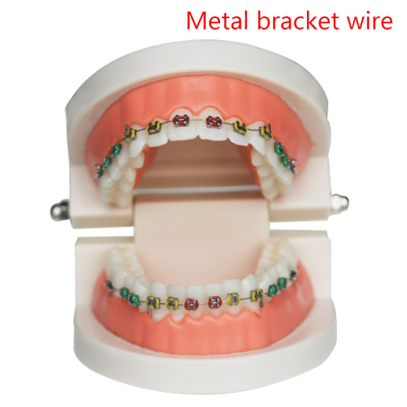1 paio di decorazioni temporanee per denti con fili metallici staffa metallica colorata e fascette per legature ortodontiche decorazioni dentali