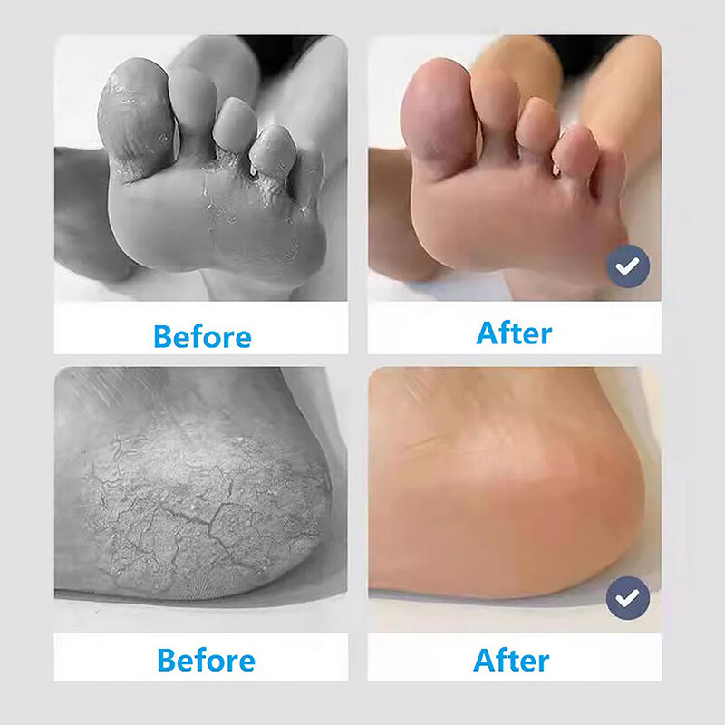 Exfoliate Feet Pedicure Handle Pumice Stone Scraper Foot File Dead Hard Rough Dry Skin Scrub Callus Remover Manual Cracked Heels