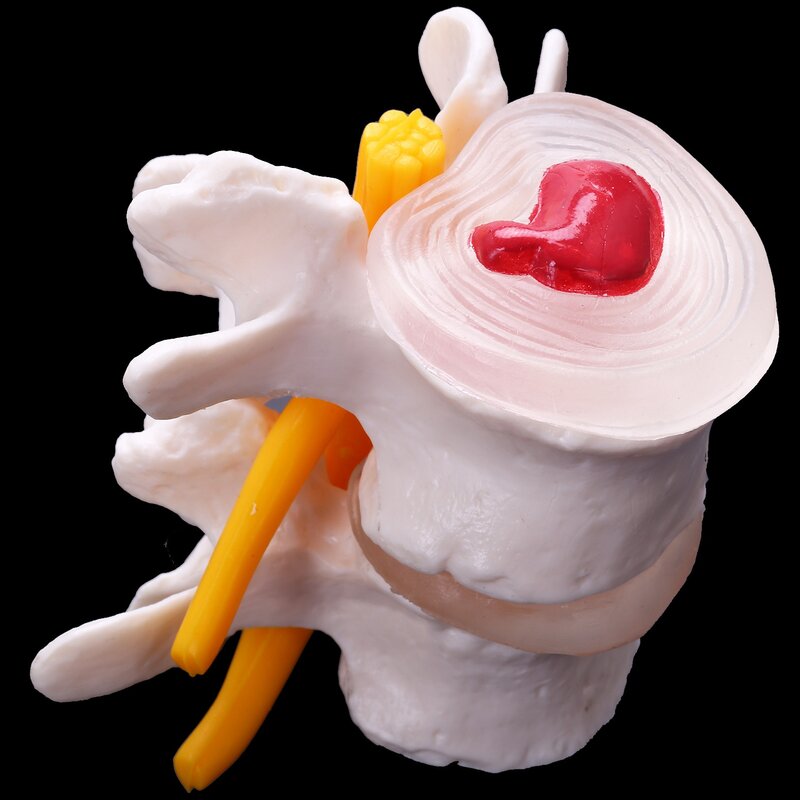 نموذج تشريح الإنسان للعمود الفقري ، قطني قطني ، دماغ ، جمجمة ، لوازم تعليمية صادمة ، 4 مراحل