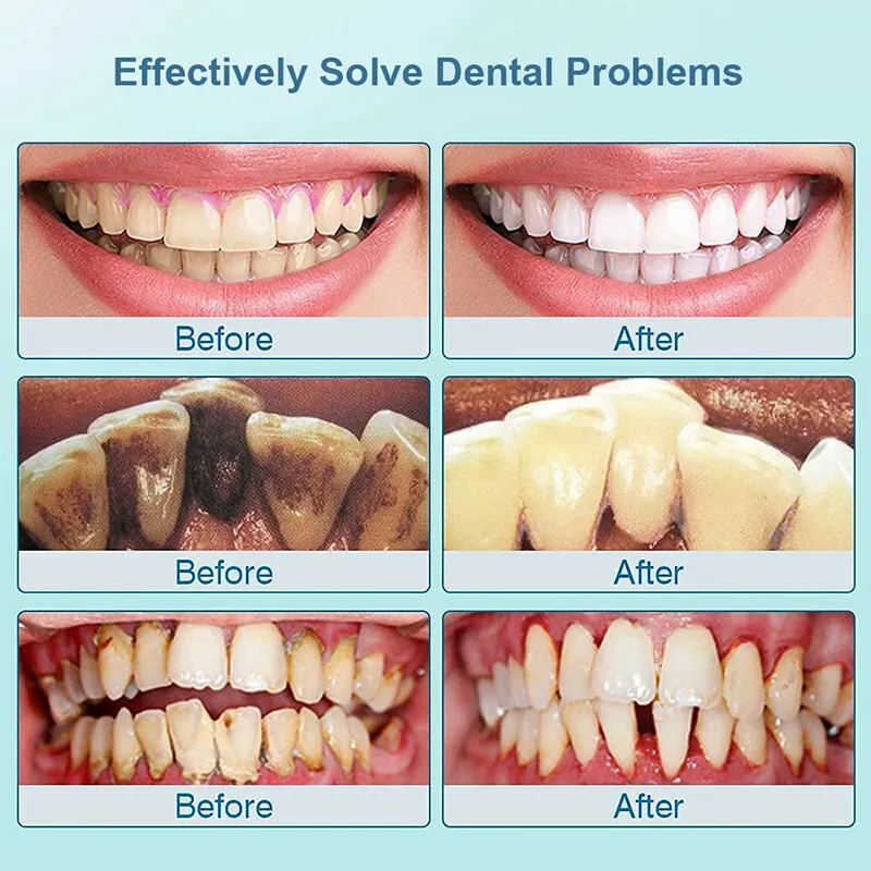 Stride Bleken Tanden Krachtig Verwijderen Gele Tandvlekken Verwijderen Slechte Adem Voorkomen Parodontitis Mond Geur Frisse Adem