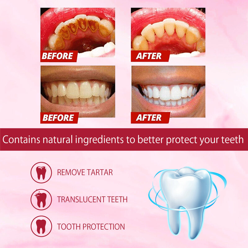 Dentifricio probiotico per carie SP 4 sbiancante pasta per la riparazione della carie detergente per denti rimozione della placca alito fresco cura dentale 120g
