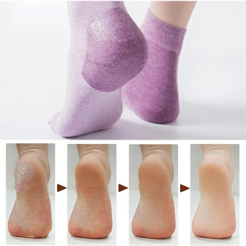 Silicone Moisturizing Gel Heel Socks Cracked Foot Dry Protector Women Ladies Solid Color Cotton Low Tube Spa Socks Crew 5 Colors