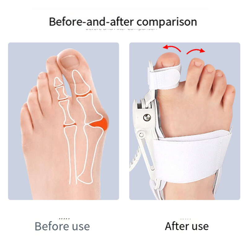 Ajustável Toe Corrector, Toe Separator, Thumb, Valgo Correção, Bunion Corrector, Finger Straightener, Pain Relief, Foot Care