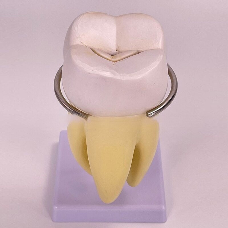 Модель человеческого зуба Анатомическая модель молярного зуба, модель зубных зубов для клиники и общения врача с пациентом