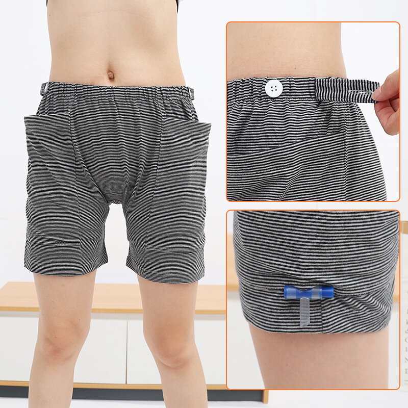 Convenient Post-Surgery Care Underwear for Intestinal and Kidney Stomas Following Colostomy and Ileostomy Procedures