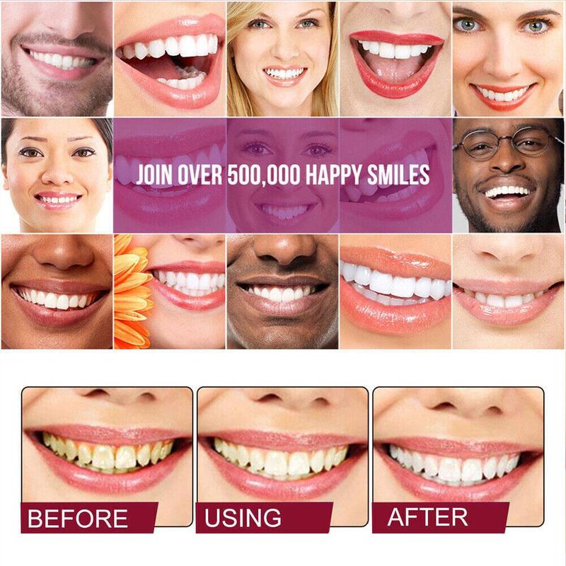 Probiotische Whitening Tandpasta Verwijderen Tandplak Vlekken Gele Tand Verse Adem Beschermt Tandvlees Tand Bleking Reparatie Tools 120G