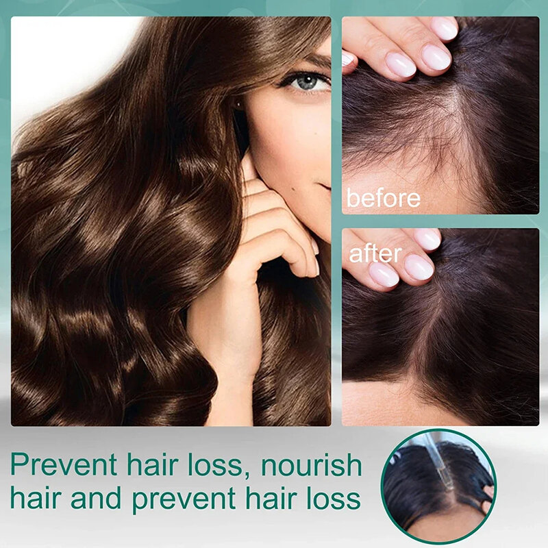Tratamiento para el crecimiento del cabello líquido, Cuatro hierbas, ingredientes naturales, productos para el crecimiento del cabello, suero para el cuidado del cabello, Serie de prevención de pérdida de cabello
