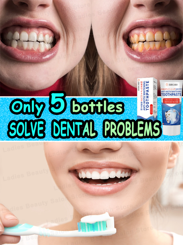 معجون أسنان بنكهة الفواكه الطازجة والعناية باللثة بالفلوريد العالي ، يحمي الأسنان ، الأفضل مبيعًا