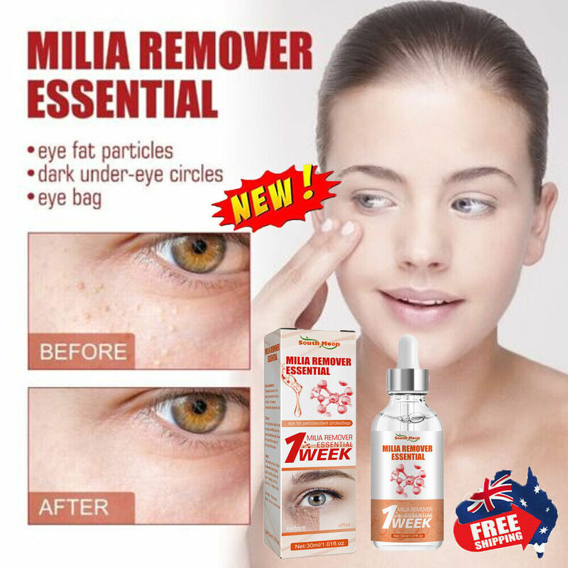 Removing Fat Grain Essence Eliminates Particles Around Eyes Tightens Dilutes Fine Lines Lifts Eye Essence Milia Spot Treatment