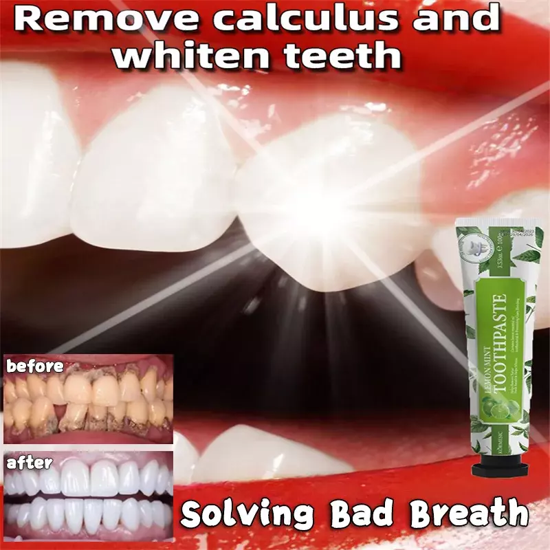 معجون أسنان مزيل لقلب الأسنان ، إزالة الأسنان الصفراء ، تنظيف رائحة الفم الكريهة ، أسنان البلاك ، منع البقع من التهاب اللثة