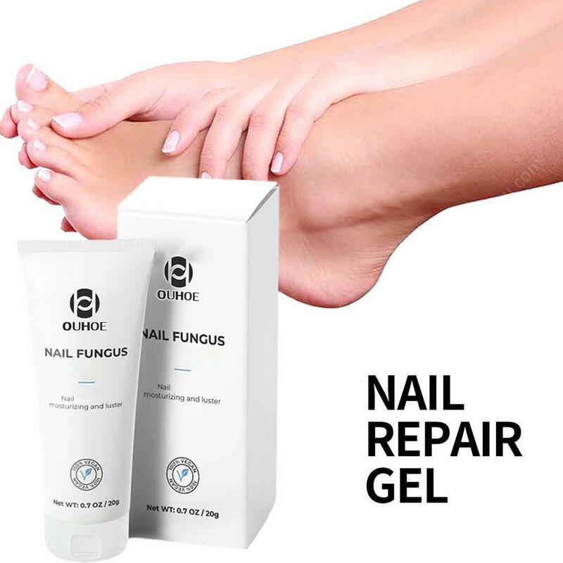 Ouhoe Nail Gel per la cura dei funghi rimuovi onicomicosi efficace cura dei piedi trattamento nutriente unghie ammorbidire e unghie contro L5u2