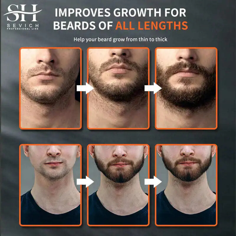 Óleo poderoso do crescimento da barba, nutrição, óleo essencial crescente, tratamento da perda de cabelo, soro, pulverizador, loção