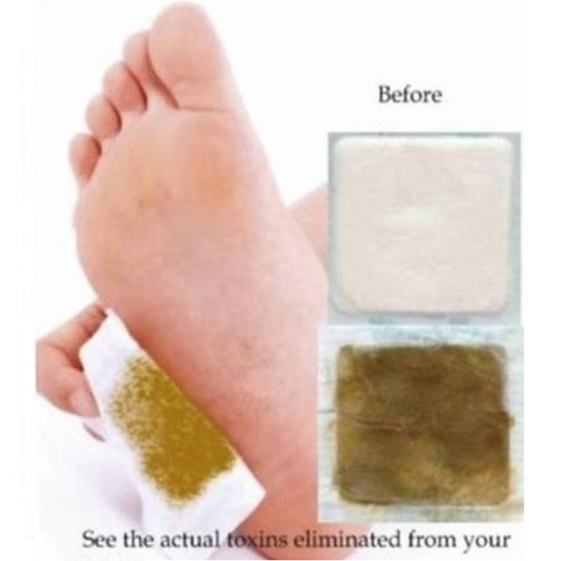 Korea Kinoki Cleansing Detox Leg Healthy Herbal Pads Ubat Feet Care Foot Spa Dropshipping Foot Care Dispel Dampness Sleep Well
