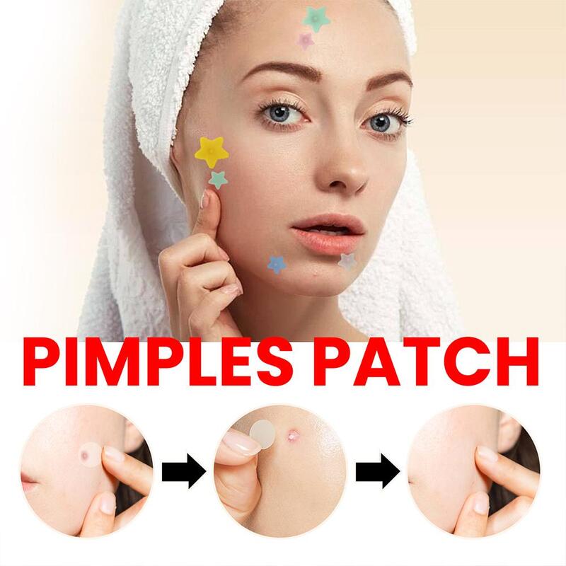 Patchs anti-acné hydrocolloïdes colorés, 200 points, mignons, en forme d'étoile, pour le visage, couverture invisible, autocollants, soins de la peau