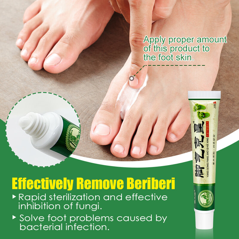 Bériberi-Crème à la menthe pour le psoriasis des pieds, pommade réparatrice, anti-démangeaison, inhibe les champignons, peeling de la peau, A941, 2 pièces