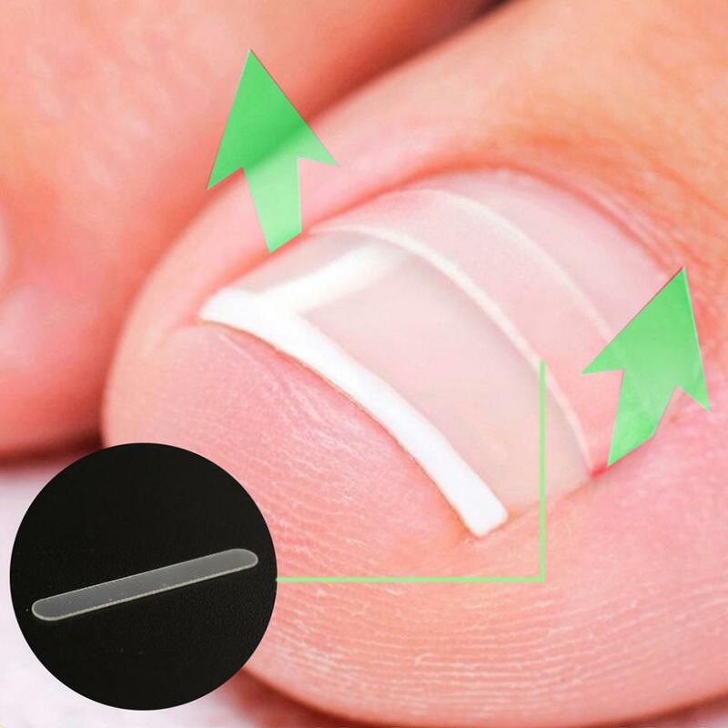 Ein gewachsene Zehen nagel Glättung sclip transparente elastische Patch Aufkleber Zehen nägel Pflege Korrektor Patch Klammer Pediküre Werkzeuge