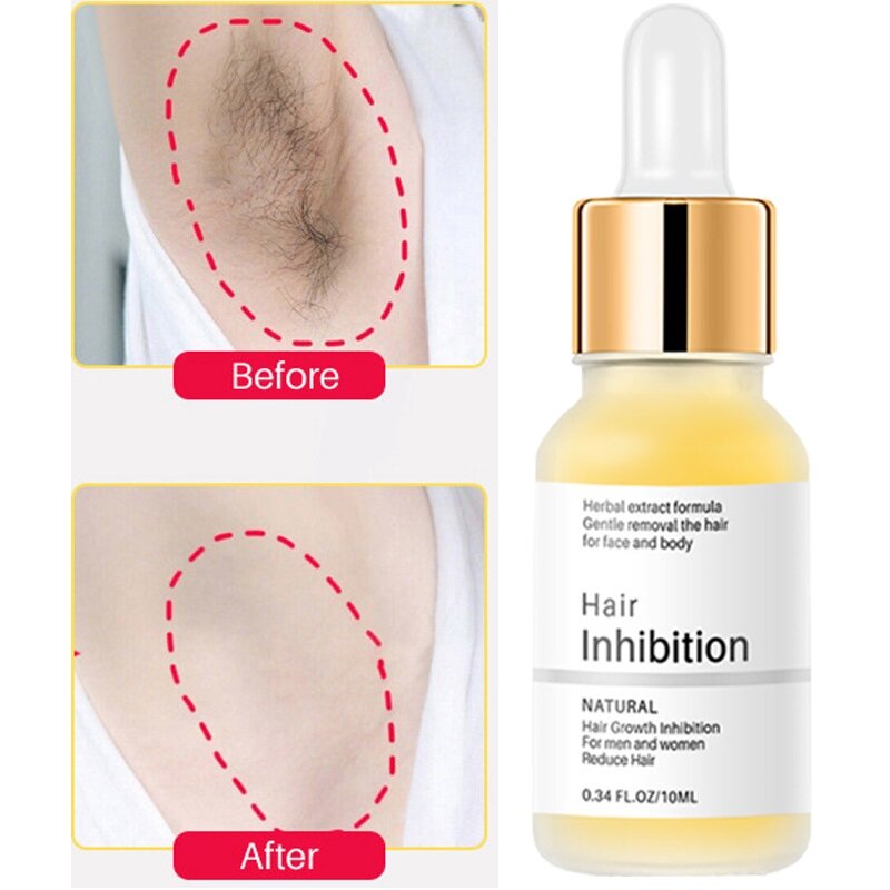 Permanent Powerful Inhibition Hair Growth Inhibitor Painless Hair Remover Serum Woman Armpit Legs Arms Fast Mild Depilatory Care