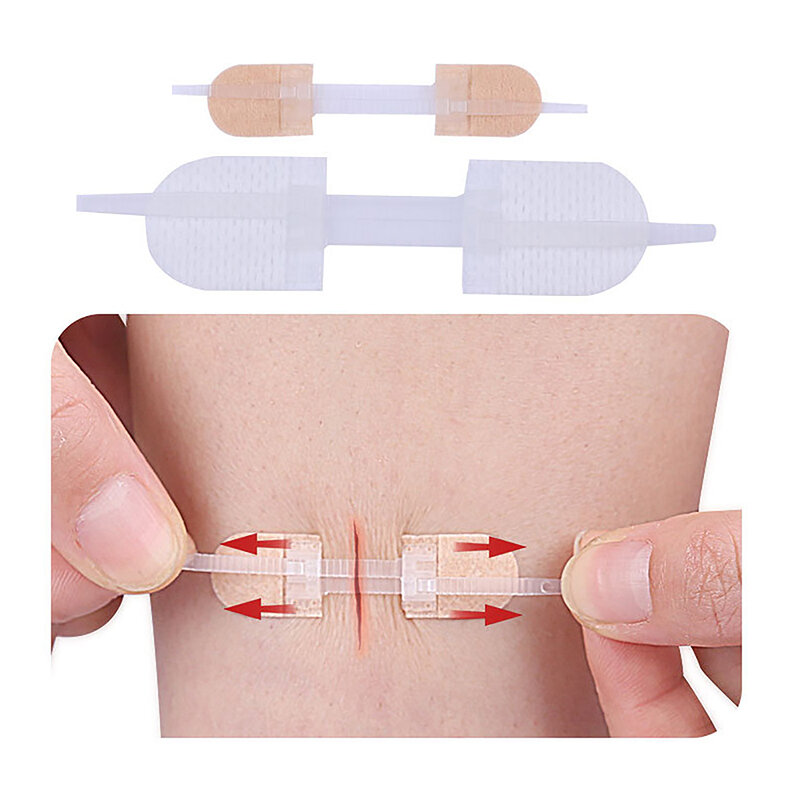 Cerotto per chiusura a fascia con cerniera Patch per chiusura a ferita cerotto emostatico avvolto Fast sutura Zipper Band-Aid Outdoor Portable
