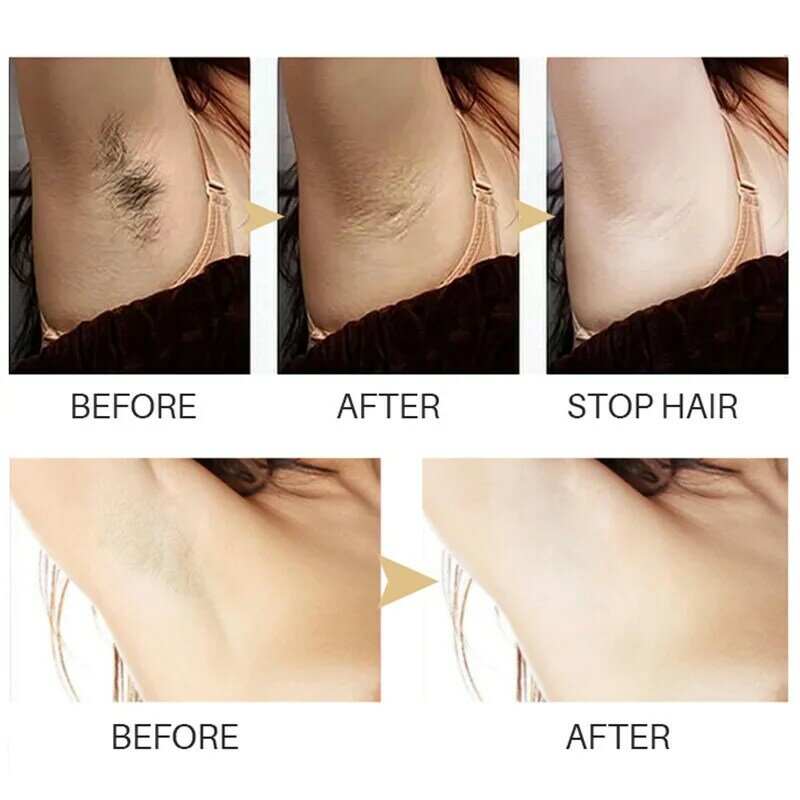 New Permanent Hair Inhibition Woman Serum Painless Hair Powerful Fast Restrain Armpit Legs Arms Hair Growth Inhibitor Depilatory
