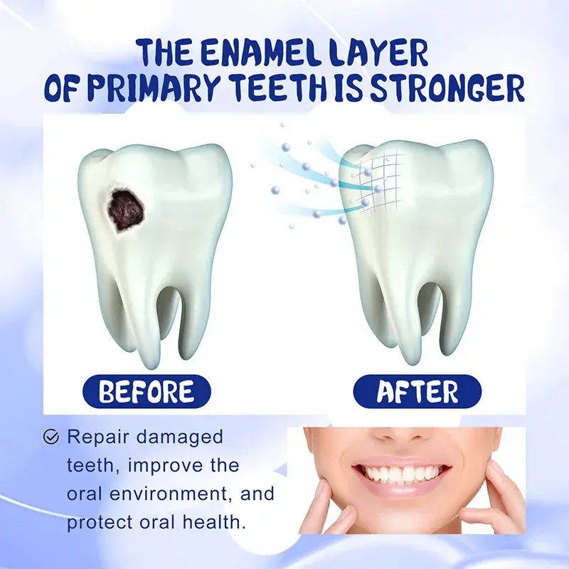 Pasta gigi Anti rusak 30g, krim perbaikan sperma gigi mencegah kerusakan gigi menghilangkan kalkulus melindungi gigi segar