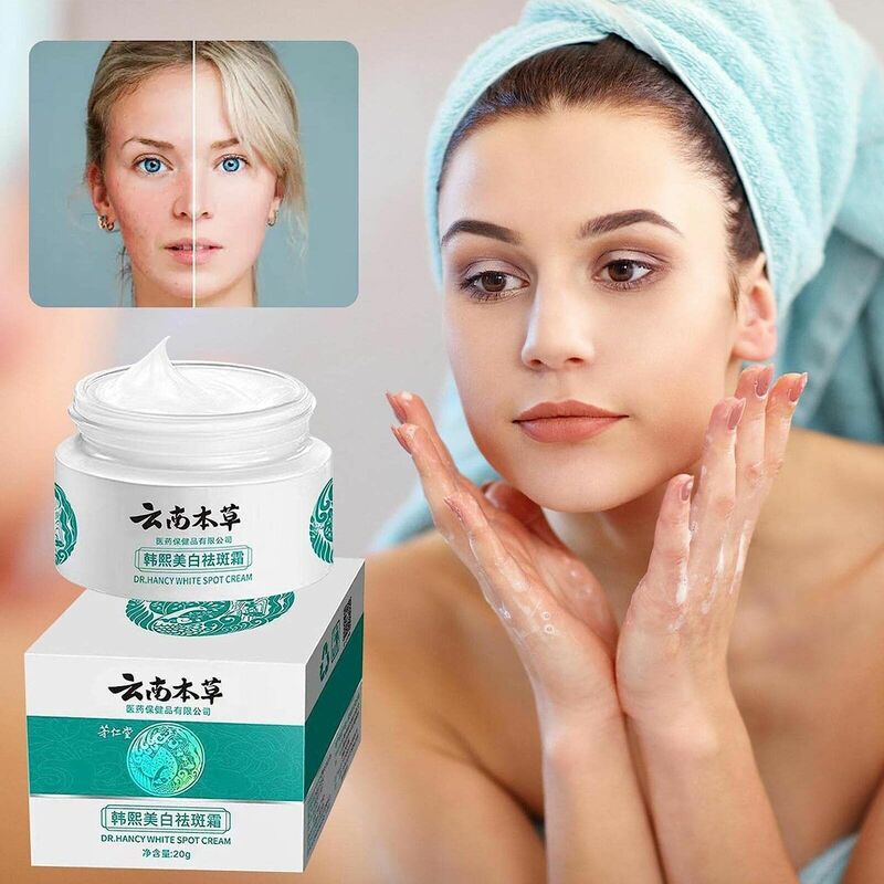 Whiten Spot Lightening Cream, Skincare Produtos, Melasma, Yunnan, Herbal, Rosto, Facial Clareamento Cremes