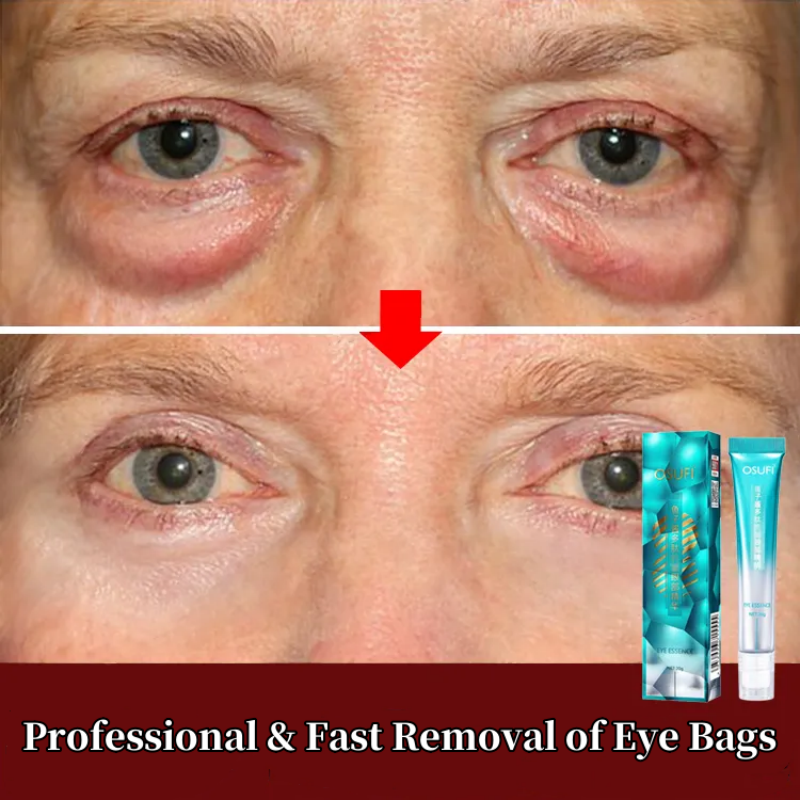Magische Augen creme 7 Tage Anti-Falten entfernen Augen taschen Augenringe Schwellungen heben feste glatte Hautpflege feuchtigkeit spendendes Massage serum
