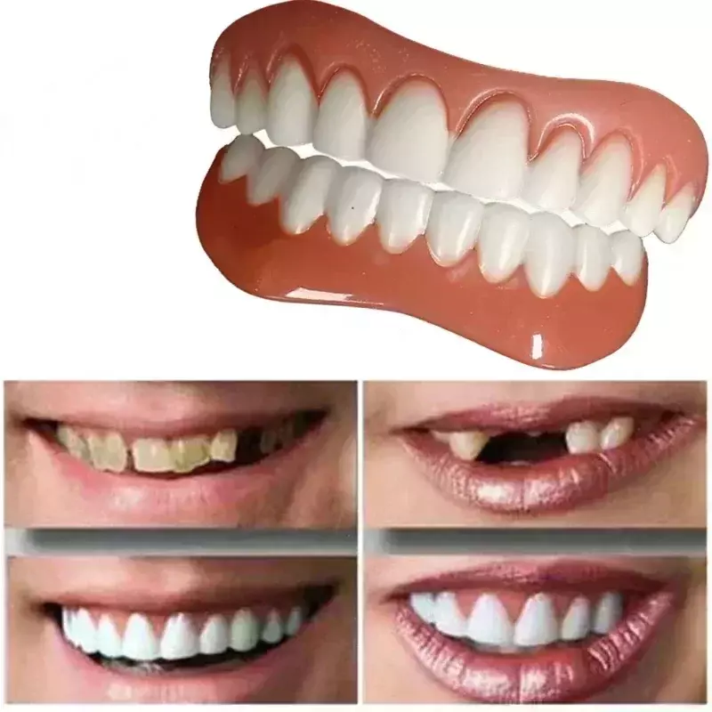 Folheados de silicone dentes falsos, aparelhos confortáveis, dentaduras ortodônticas, aparelhos para folheados superior e inferior, superior e inferior