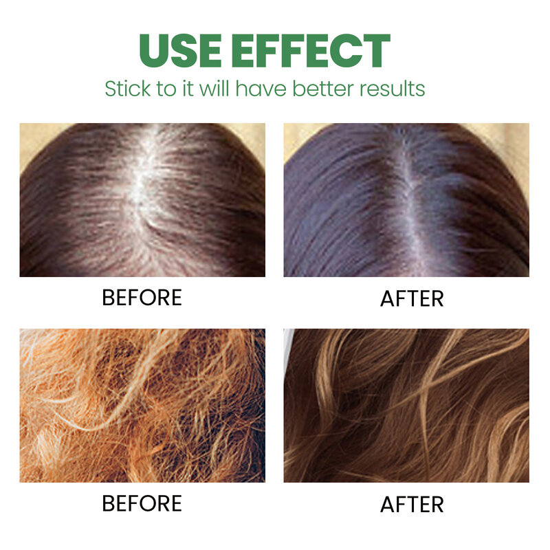 Leave-in arroz crescimento do cabelo spray anti perda de cabelo densas raízes do cabelo reparação danificado cabelo nutrir hidratante tratamento do couro cabeludo cuidados