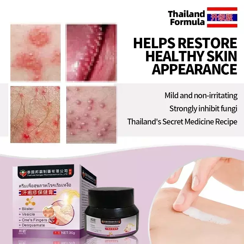 Herpes Zoster tratamento creme, telhas cura, medicina da pele, minério de cobra, ponto vermelho, bolha, simplex, pomada Tailândia, 50g