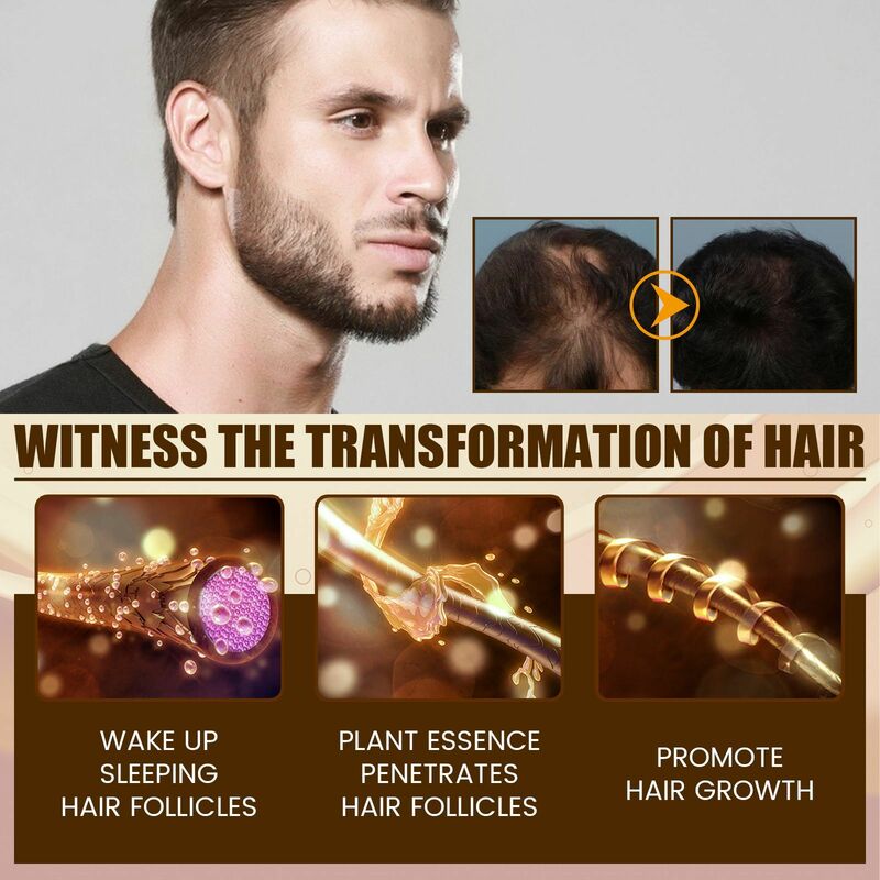 Olio per la crescita dei capelli ricrescita Dense Repair calvizie perdita arbitraria secco danneggiato rafforzamento siero nutriente liscio per il trattamento del cuoio capelluto