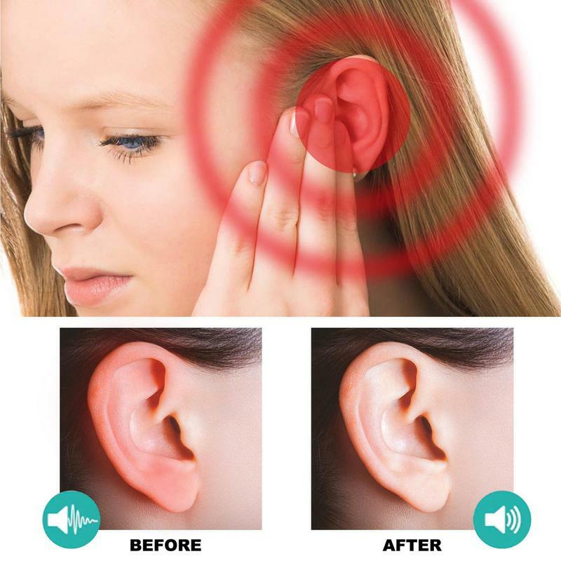 Ear Drops Tinnitus portátil, Gotas para suporte auditivo, Gotas de dor de ouvido multifuncionais, não irritante, 30ml