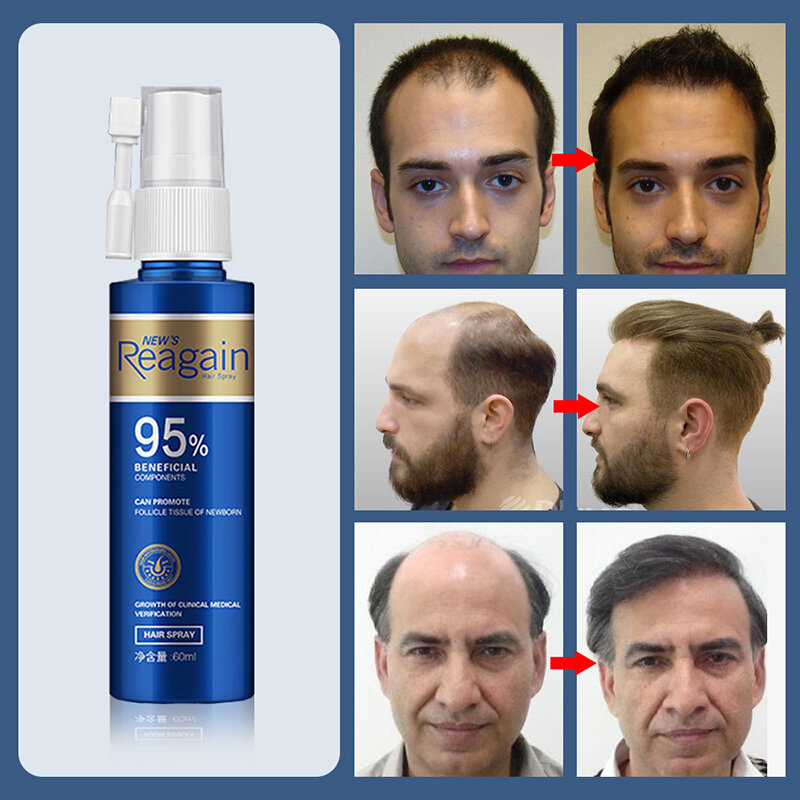 Spray à l'huile d'essence de croissance des cheveux, traitement anti-chute de cheveux, réparation de l'huile de croissance de la barbe, racines capillaires endommagées, produit de soin des cheveux