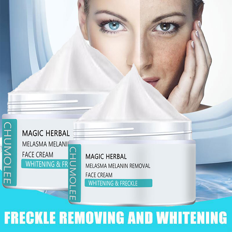 Creme de clareamento eficaz remover melasma acne mancha pigmentação mancha escura skincare