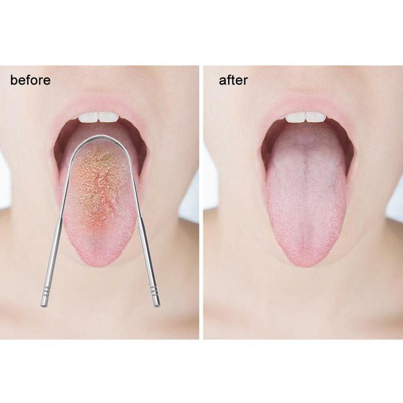 1 pz raschietto per lingua in acciaio inox detergente per lingua rimozione dell'alitosi strumenti per l'igiene orale