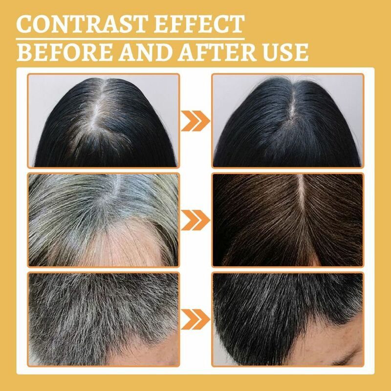 1PC  Anti Greying Hair Serum Ganoderma Nutrient Natural Darkening Serum Repair Strengthen Hair Roots Growth Oil For Women Men