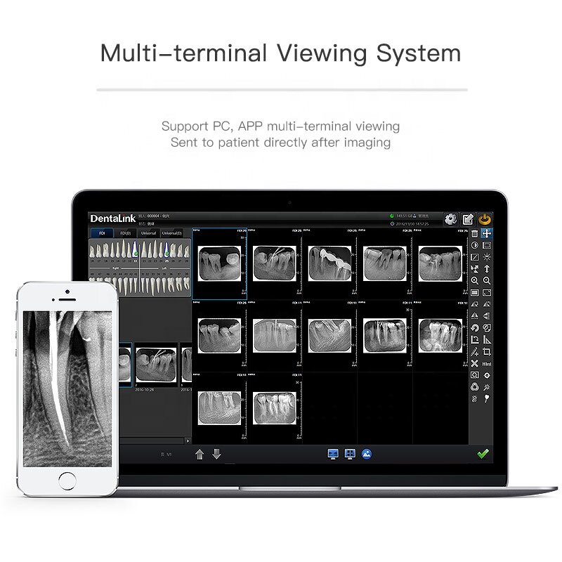 Fussen Dental Oral Imaging Plate Smart Sensing Processing High Definition X-Ray Image scanning Scanner Machine