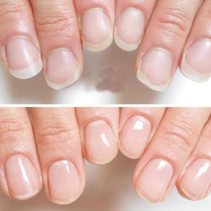 Tinovo Uno Natural Nail Growth Complex 9 IN 1 Nail Art Treatment Therapy per la cura della riparazione unghie fragili sottili Top Coat indurente