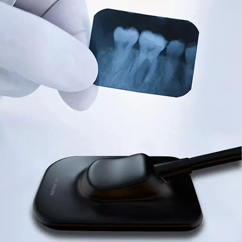 Udoskonal czujnik wyjątkowe obrazy dla dentystów w celu precyzyjnej diagnozy, skuteczne planowanie leczenia pacjenta poprawiające wydajność